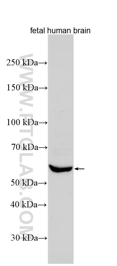 WB analysis using 31017-1-AP