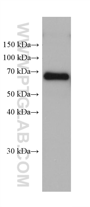 WB analysis of human placenta using 67965-1-Ig (same clone as 67965-1-PBS)