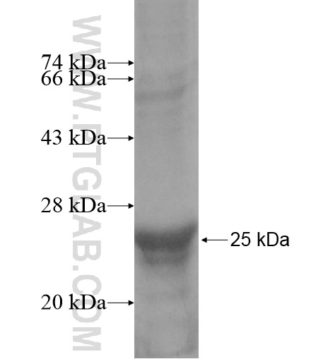 MFSD7 fusion protein Ag15645 SDS-PAGE MFSD7 fusion protein Ag15645 SDS-PAGE