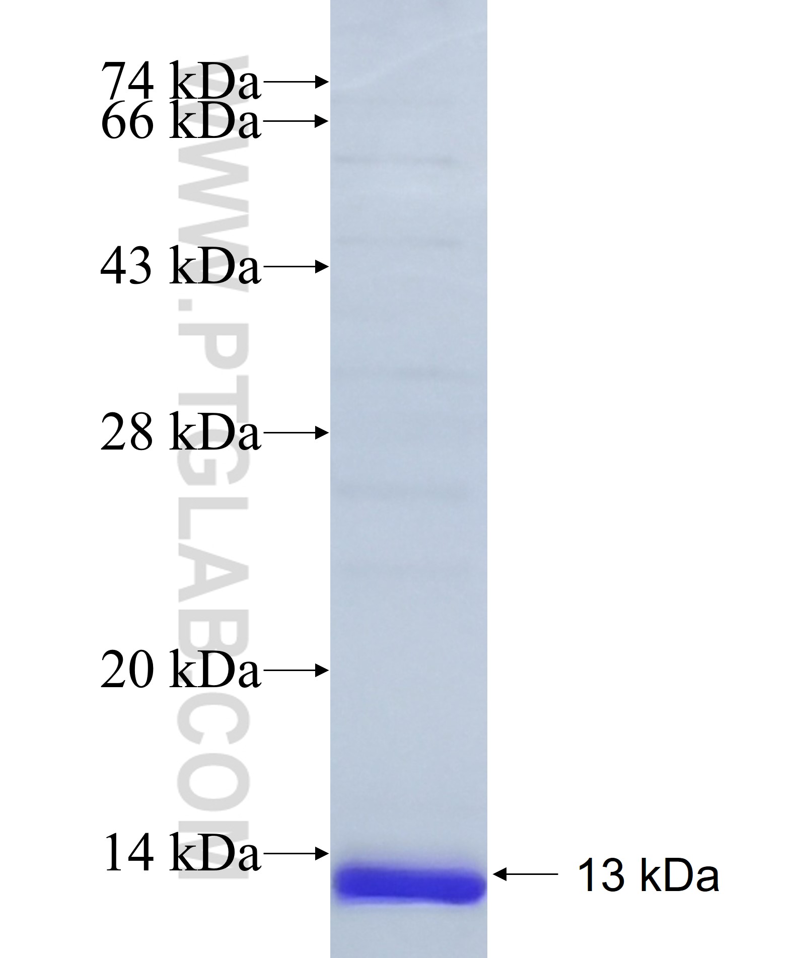 MFSD8 fusion protein Ag18086 SDS-PAGE