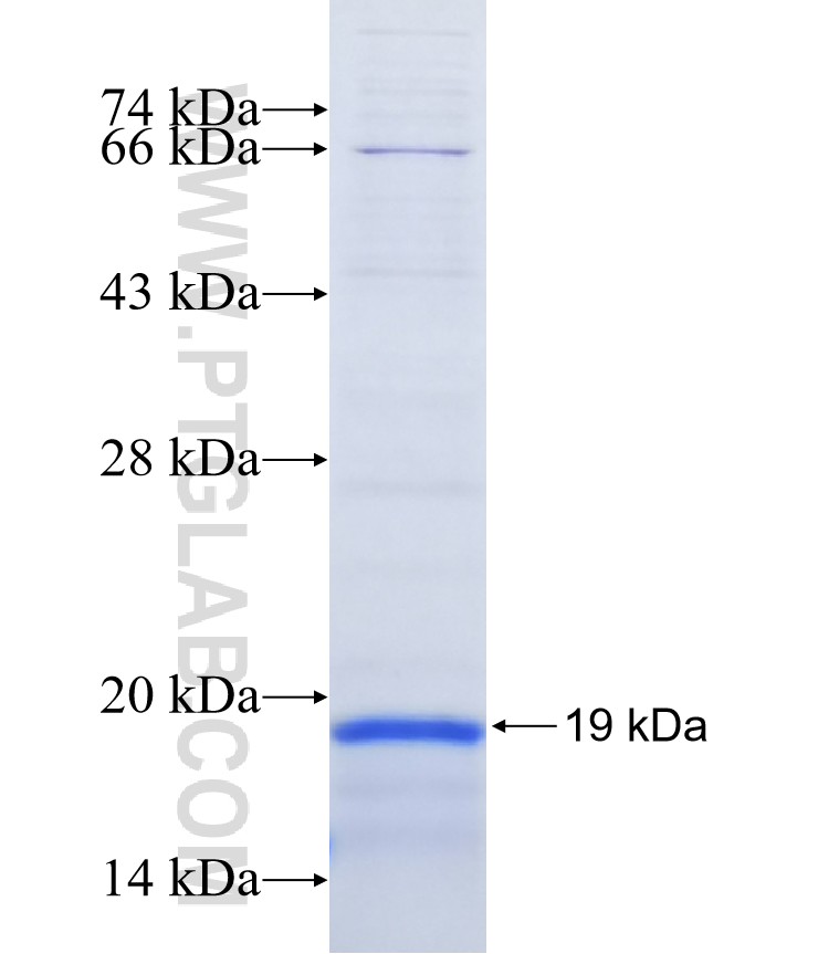 MFSD9 fusion protein Ag15161 SDS-PAGE