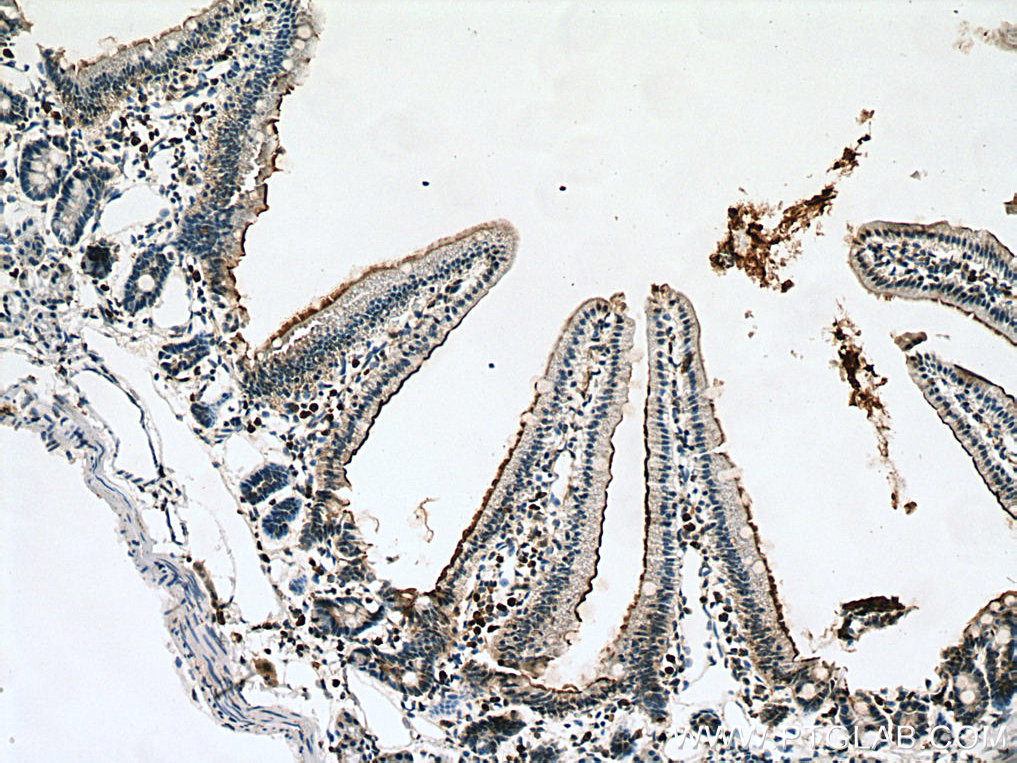 IHC staining of mouse small intestine using 22195-1-AP