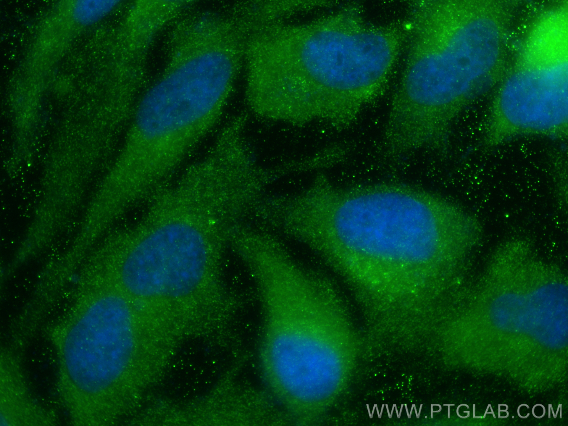 IF Staining of HeLa using 15103-1-AP