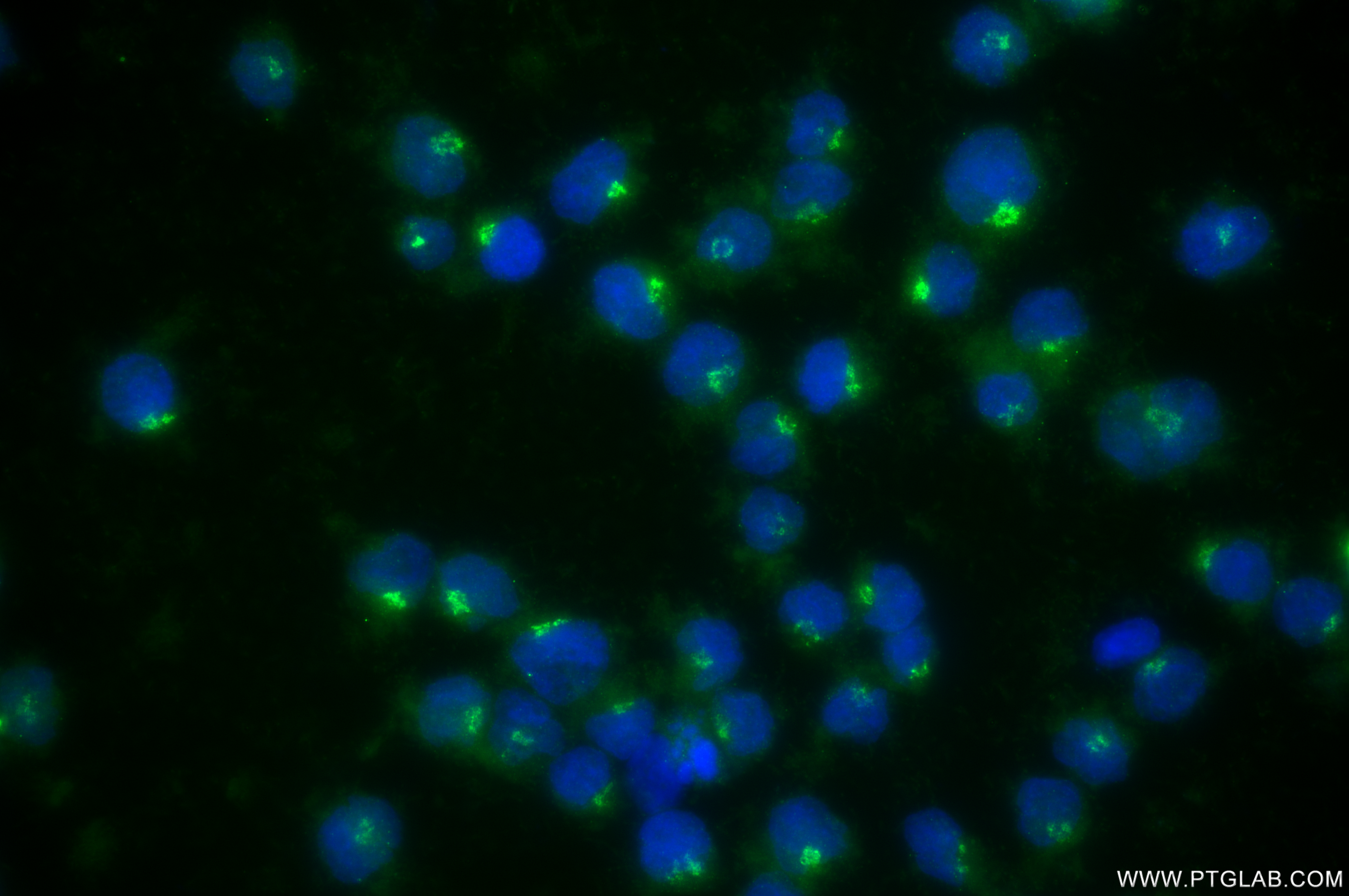 Immunofluorescent analysis of (4% PFA) fixed Raji cells using MGAT2 antibody (85933-1-RR, Clone: 250147B1 ) at dilution of 1:400 and CoraLite®488-Conjugated Goat Anti-Rabbit IgG(H+L) (<a class='green' href='/productredirect?CatalogNo=SA00013-2' target='_blank'>SA00013-2</a>). IF Staining of Raji using 85933-1-RR