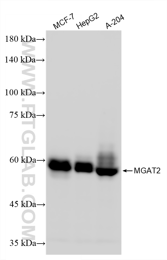 Various lysates were subjected to SDS PAGE followed by western blot with 85933-1-RR (MGAT2 antibody) at dilution of 1:20000 incubated at room temperature for 1.5 hours. WB analysis using 85933-1-RR