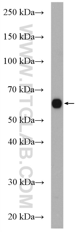 WB analysis of COLO 320 using 17869-1-AP