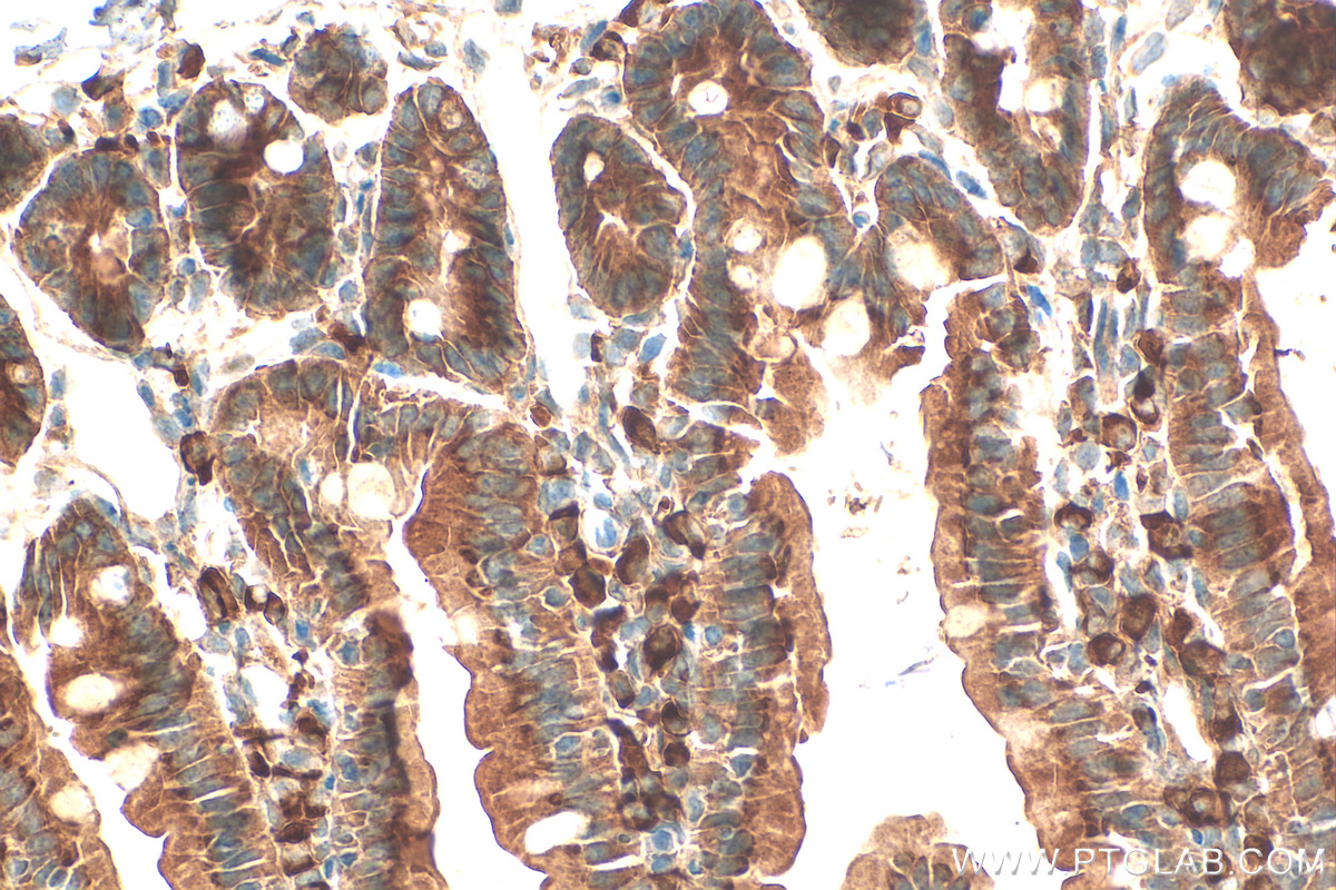 IHC staining of mouse small intestine using 25109-1-AP