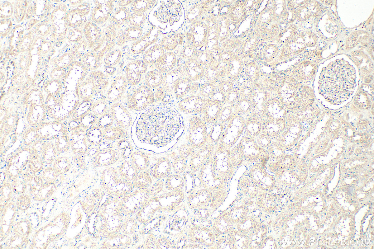IHC staining of human kidney using 25109-1-AP