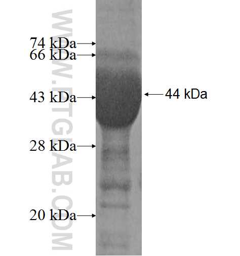 MGAT4B fusion protein Ag9476 SDS-PAGE