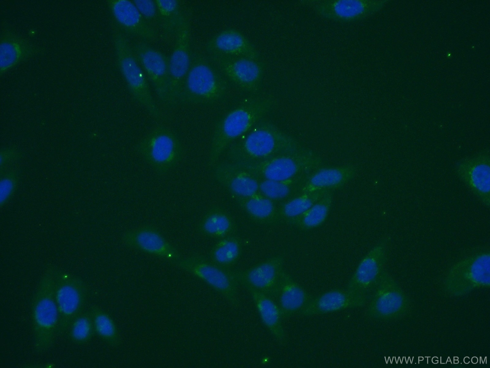 IF Staining of HepG2 using 16993-1-AP