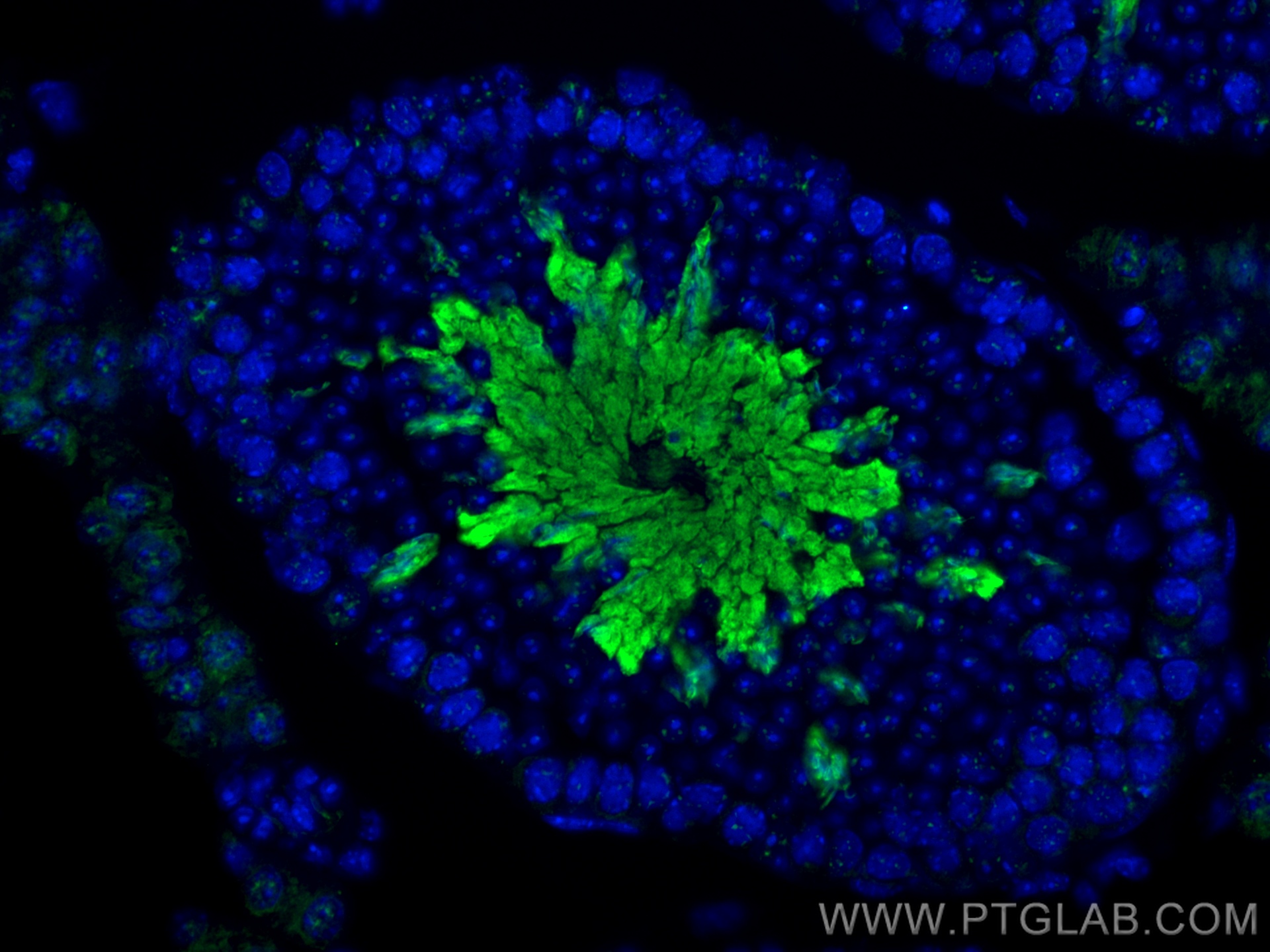 IF Staining of mouse testis using 29885-1-AP