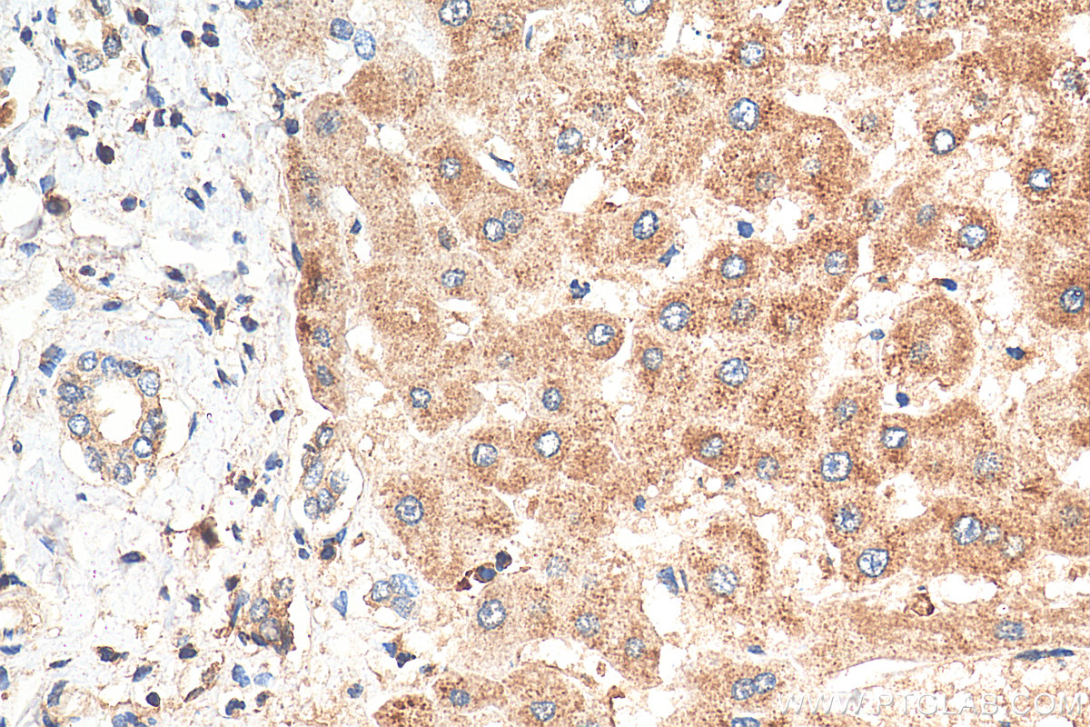 IHC staining of human liver using 29885-1-AP