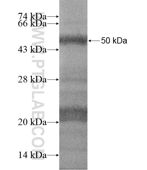 MGC42105 fusion protein Ag19790 SDS-PAGE MGC42105 fusion protein Ag19790 SDS-PAGE