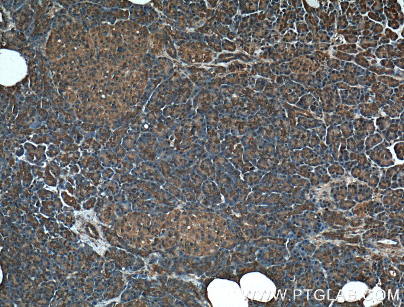 MGEA5 Polyclonal antibody