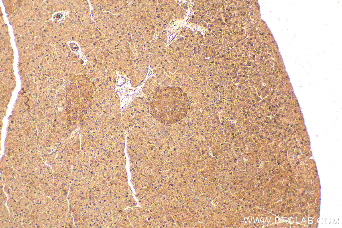 IHC staining of mouse pancreas using 14711-1-AP