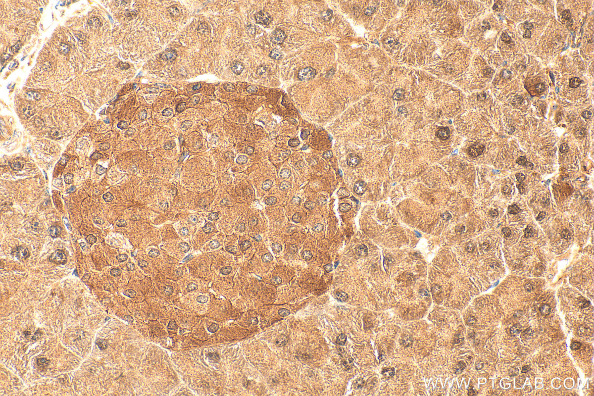IHC staining of mouse pancreas using 14711-1-AP