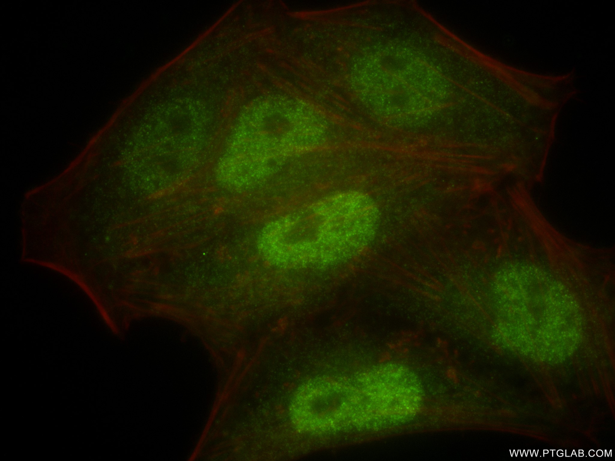 IF Staining of HepG2 using 84722-4-RR (same clone as 84722-4-PBS)