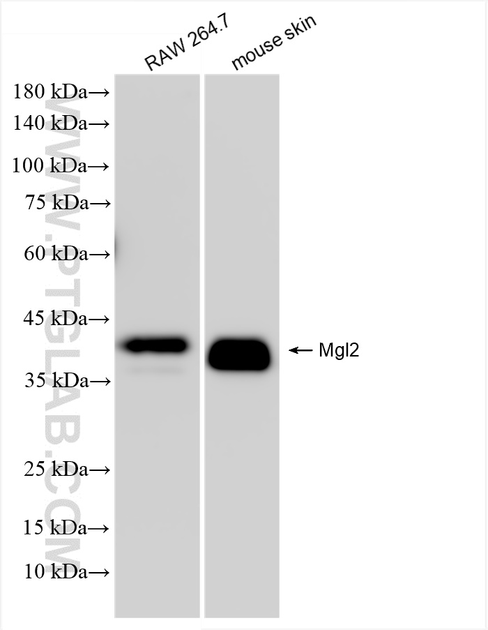WB analysis using 85876-1-RR