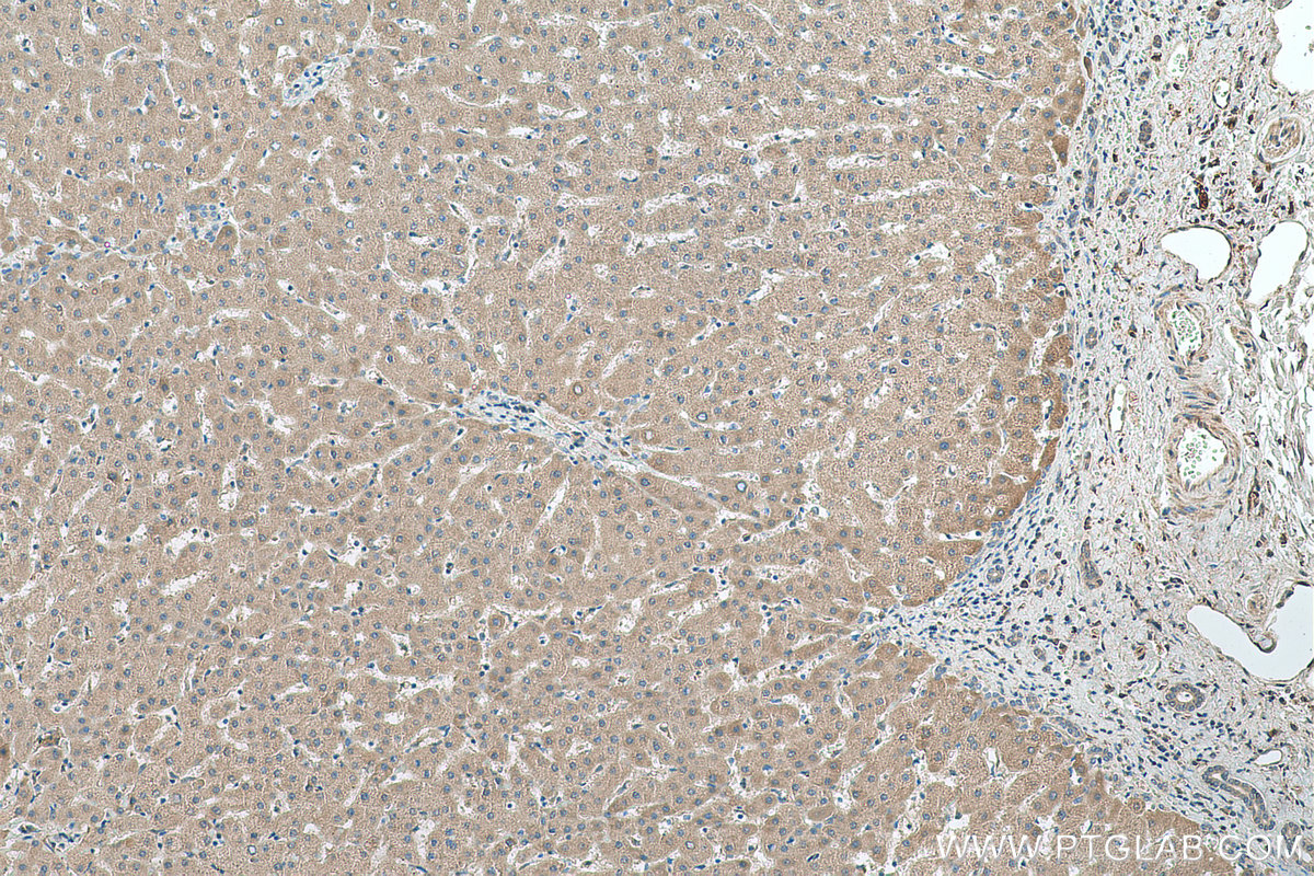 IHC staining of human liver using 14986-1-AP