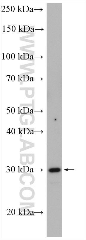 WB analysis of HepG2 using 14986-1-AP