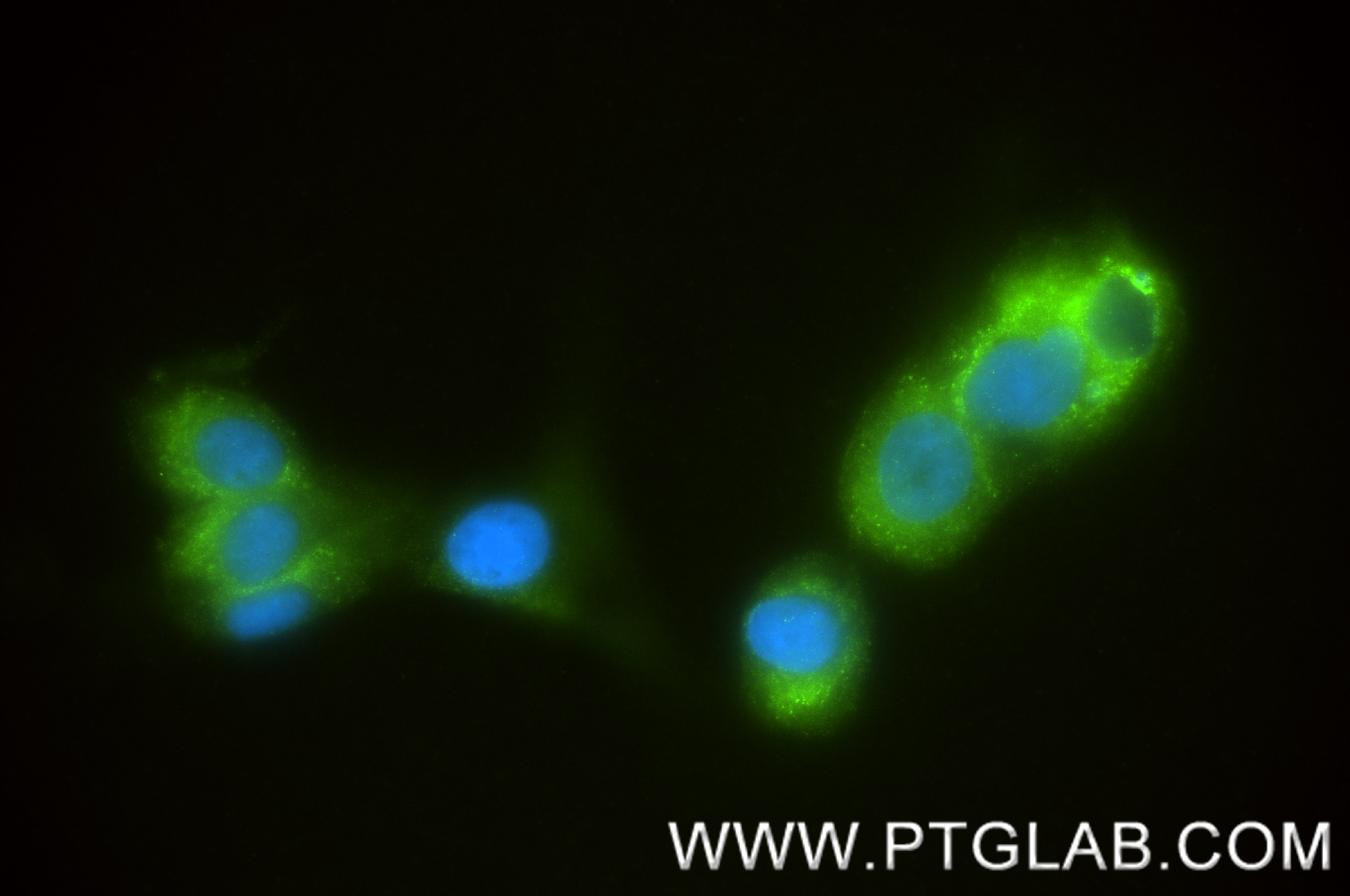 Immunofluorescent analysis of (-20°C Ethanol) fixed U-87 MG cells using MGLL antibody (86087-2-RR, Clone: 250509G3 ) at dilution of 1:400 and CoraLite®488-Conjugated Goat Anti-Rabbit IgG(H+L) (<a class='green' href='/productredirect?CatalogNo=SA00013-2' target='_blank'>SA00013-2</a>). IF Staining of U-87 MG using 86087-2-RR