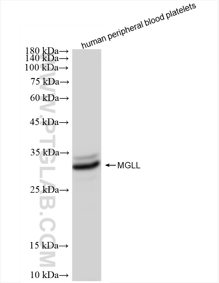 WB analysis of human peripheral blood platelets using 86087-2-RR (same clone as 86087-2-PBS)