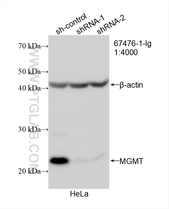 WB analysis of HeLa using 67476-1-Ig