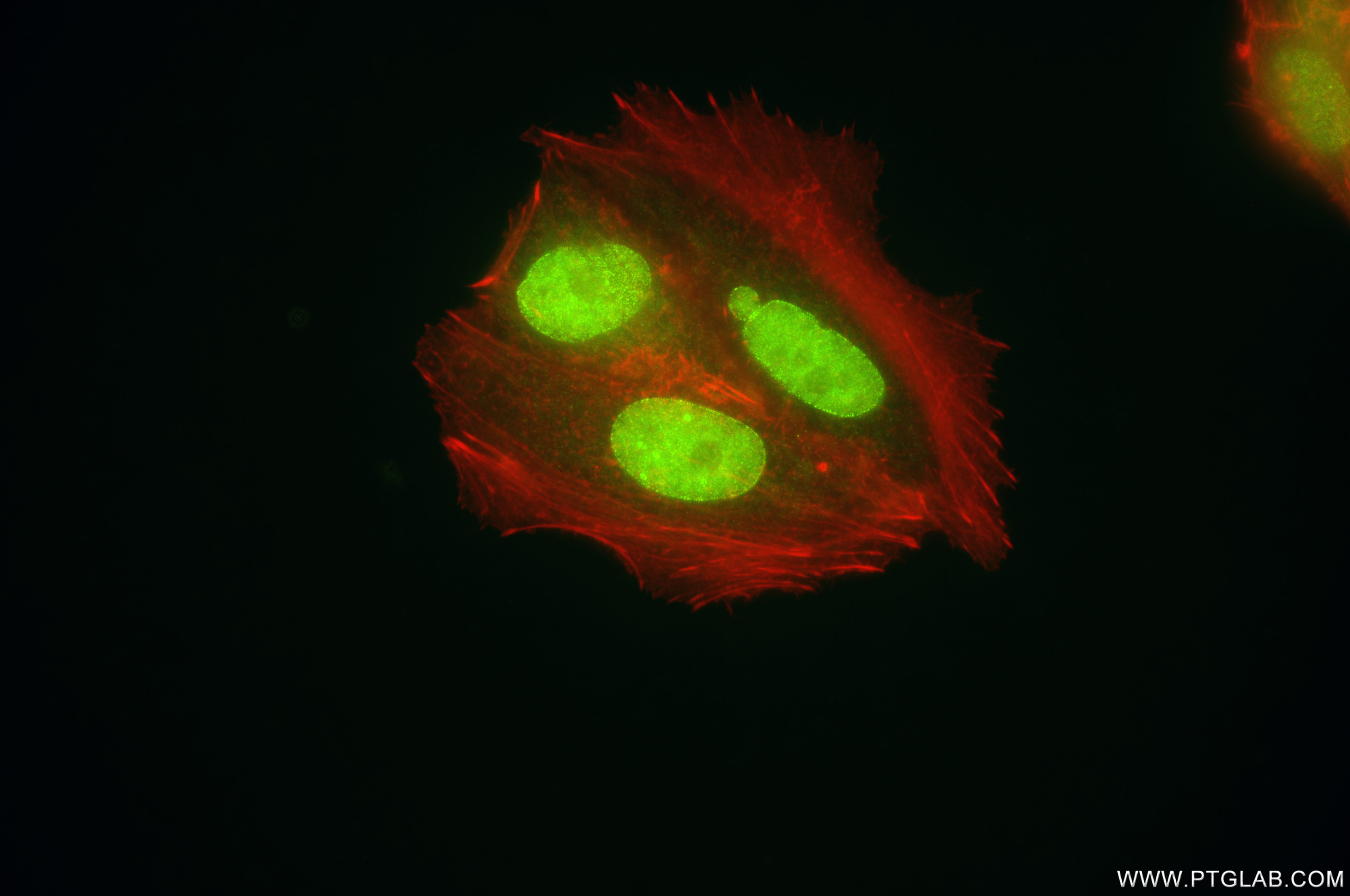 IF Staining of MCF-7 using 86115-5-RR (same clone as 86115-5-PBS)