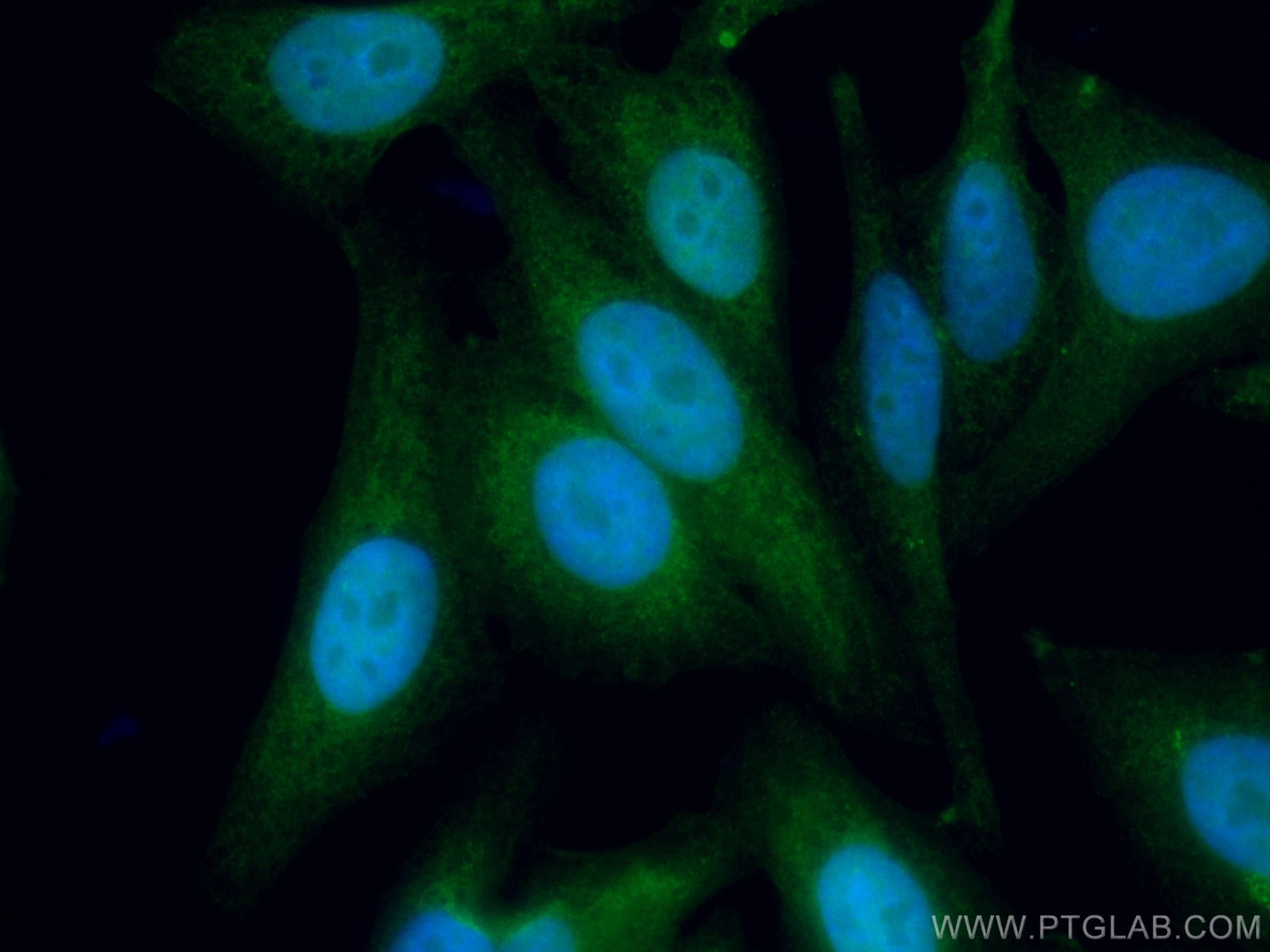 IF Staining of HepG2 using CL488-67476