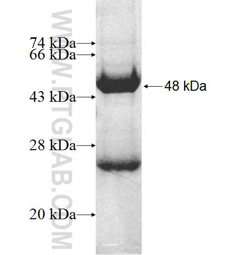 MGMT fusion protein Ag9996 SDS-PAGE