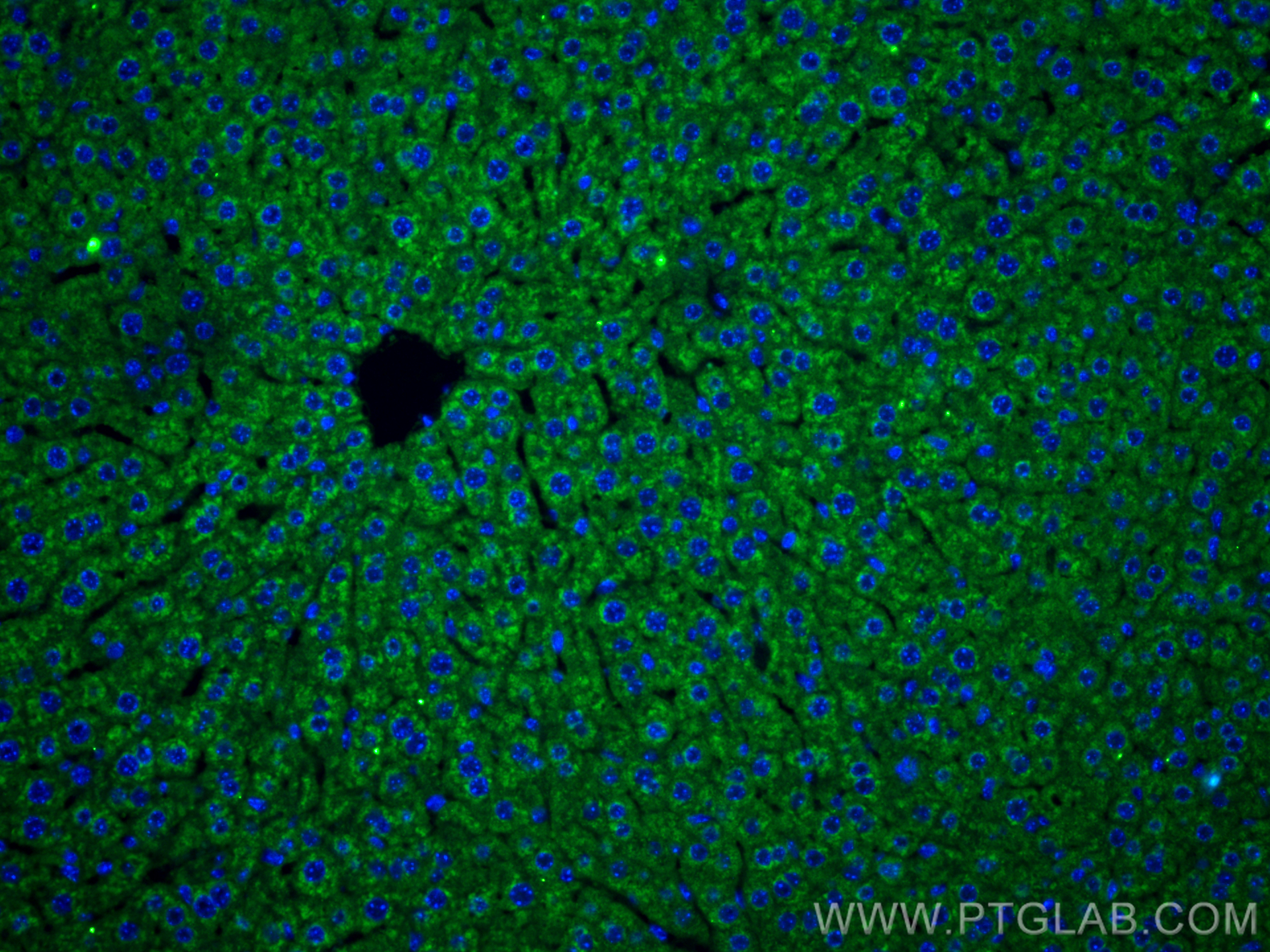 IF Staining of mouse liver using 10734-1-AP