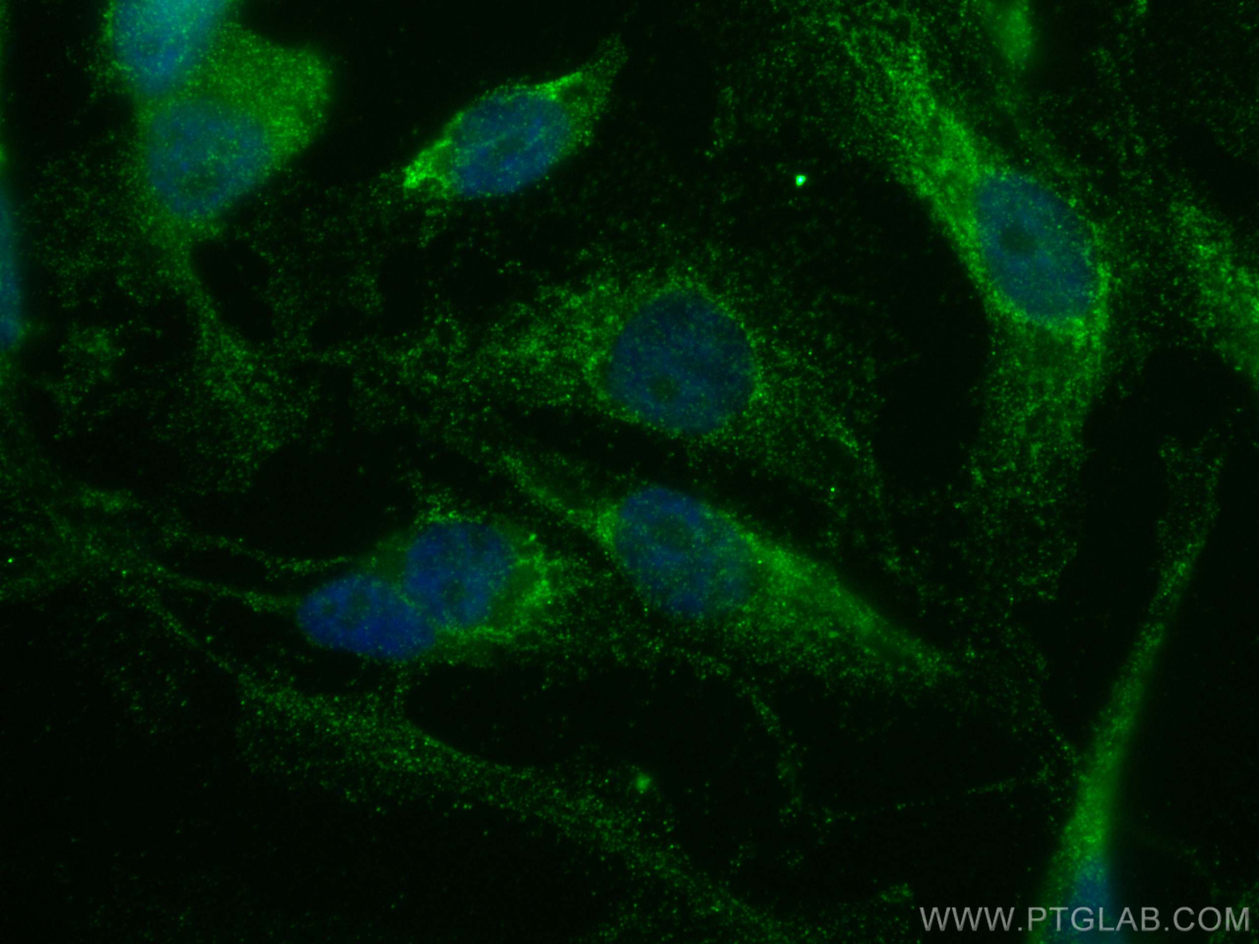 IF Staining of MDA-MB-231 using 60055-1-Ig