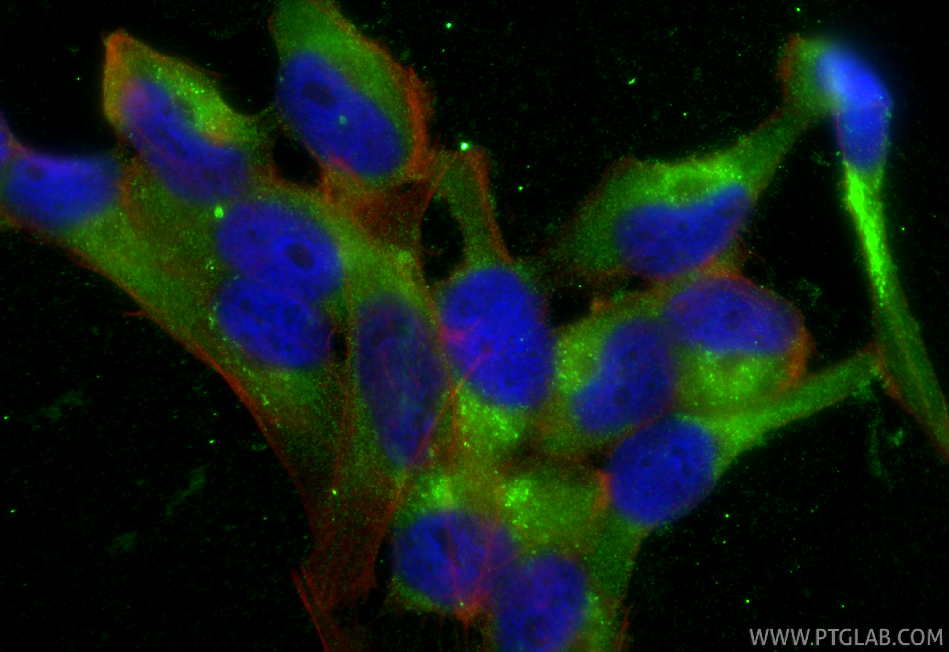 Immunofluorescent analysis of (-20°C Ethanol) fixed AC16 cells using MGP antibody (60055-1-Ig, Clone: 1A1C3 ) at dilution of 1:400 and CoraLite®488-Conjugated Goat Anti-Mouse IgG(H+L) (<a class='green' href='/productredirect?CatalogNo=SA00013-1' target='_blank'>SA00013-1</a>), CL594-Phalloidin (red). IF Staining of AC16 using 60055-1-Ig
