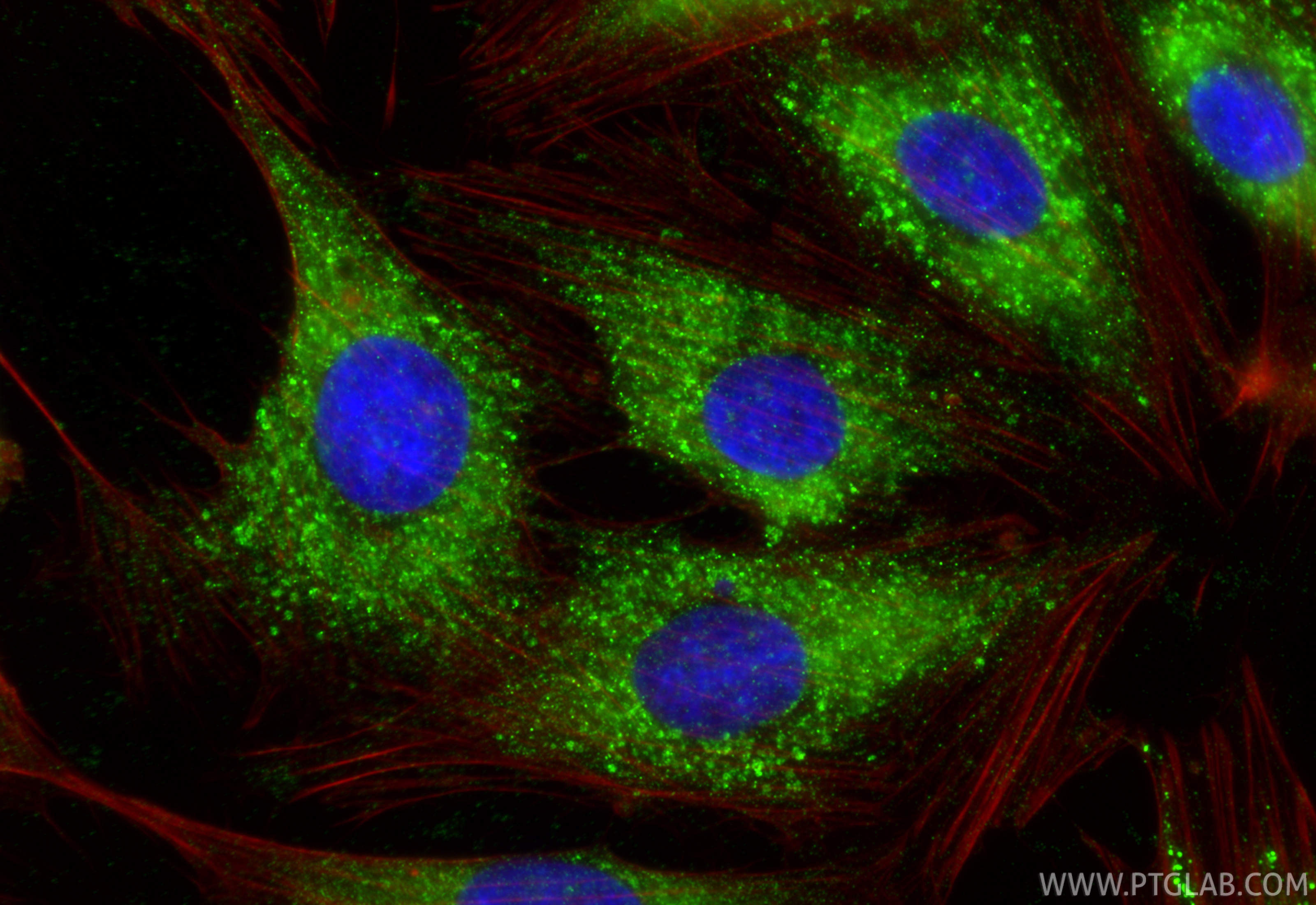 Immunofluorescent analysis of (-20°C Ethanol) fixed H9C2 cells using MGP antibody (60055-1-Ig, Clone: 1A1C3 ) at dilution of 1:400 and CoraLite®488-Conjugated Goat Anti-Mouse IgG(H+L) (<a class='green' href='/productredirect?CatalogNo=SA00013-1' target='_blank'>SA00013-1</a>), CL594-Phalloidin (red). IF Staining of H9C2 using 60055-1-Ig
