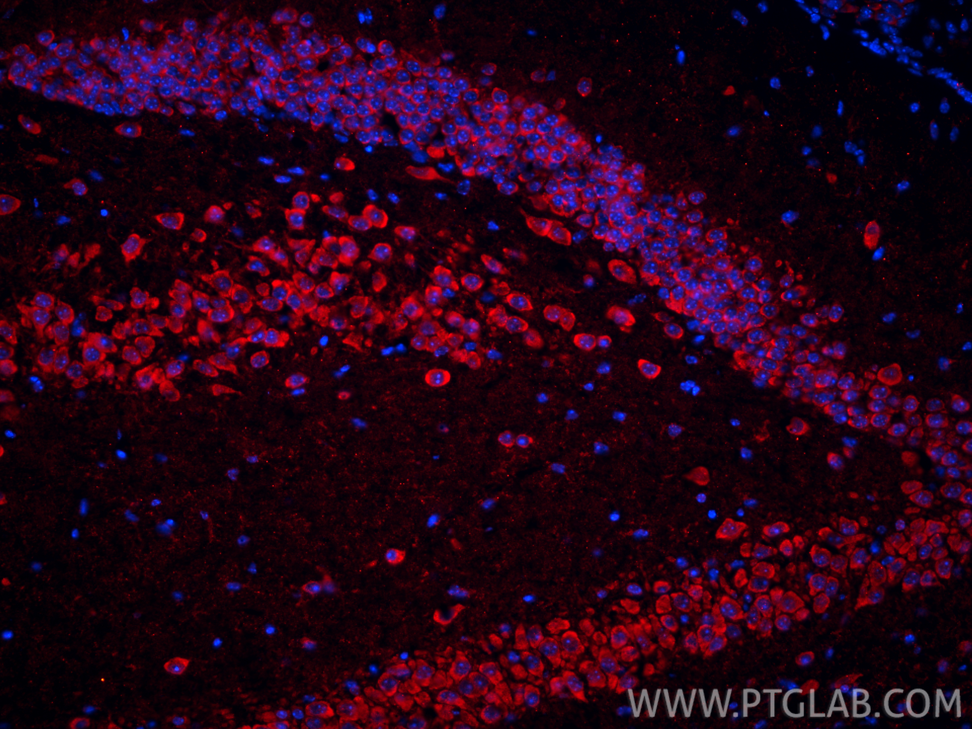 Immunofluorescent analysis of (4% PFA) fixed frozen OCT-embedded mouse brain tissue using MGP antibody (60055-1-Ig, Clone: 1A1C3 ) at dilution of 1:800 and CoraLite®594-Conjugated Goat Anti-Mouse IgG(H+L) (<a class='green' href='/productredirect?CatalogNo=SA00013-3' target='_blank'>SA00013-3</a>). IF Staining of mouse brain using 60055-1-Ig