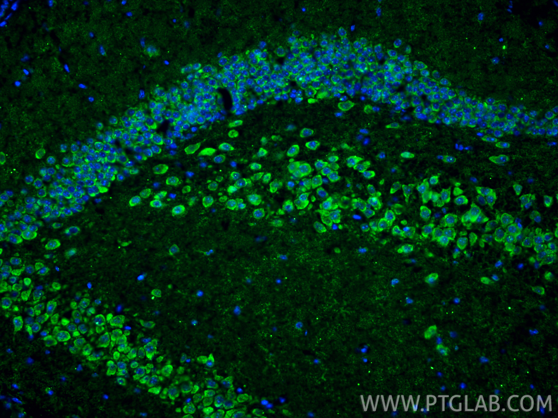 Immunofluorescent analysis of (4% PFA) fixed frozen OCT-embedded mouse brain tissue using MGP antibody (60055-1-Ig, Clone: 1A1C3 ) at dilution of 1:800 and CoraLite®488-Conjugated Goat Anti-Mouse IgG(H+L) (<a class='green' href='/productredirect?CatalogNo=SA00013-1' target='_blank'>SA00013-1</a>). IF Staining of mouse brain using 60055-1-Ig