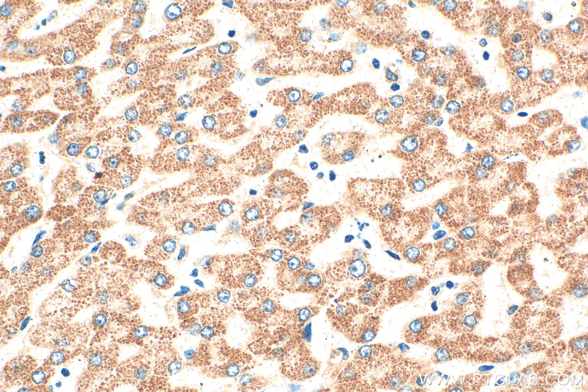 IHC staining of human liver using 15906-1-AP