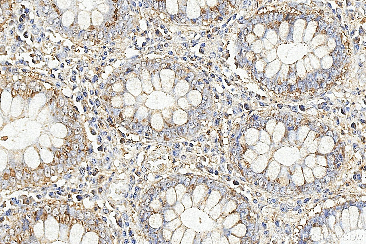 IHC staining of human colon using 25451-1-AP