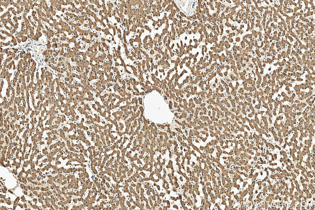 IHC staining of human liver using 25451-1-AP