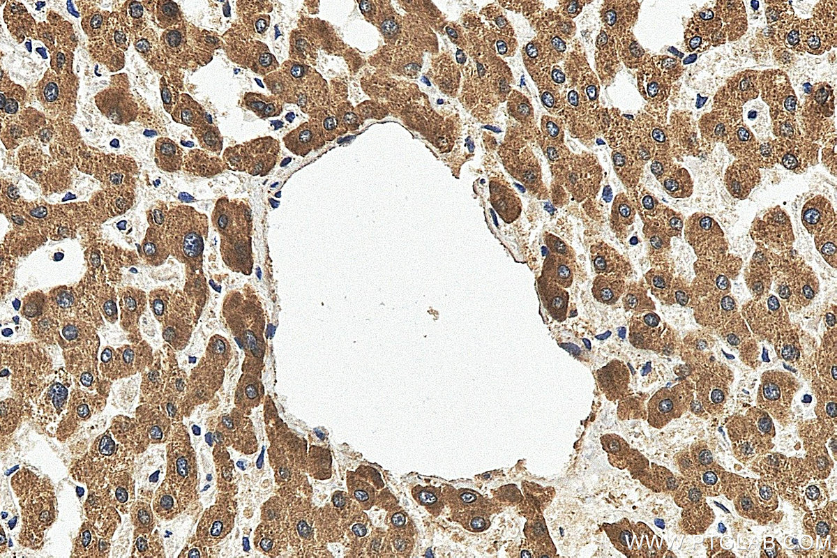 IHC staining of human liver using 25451-1-AP
