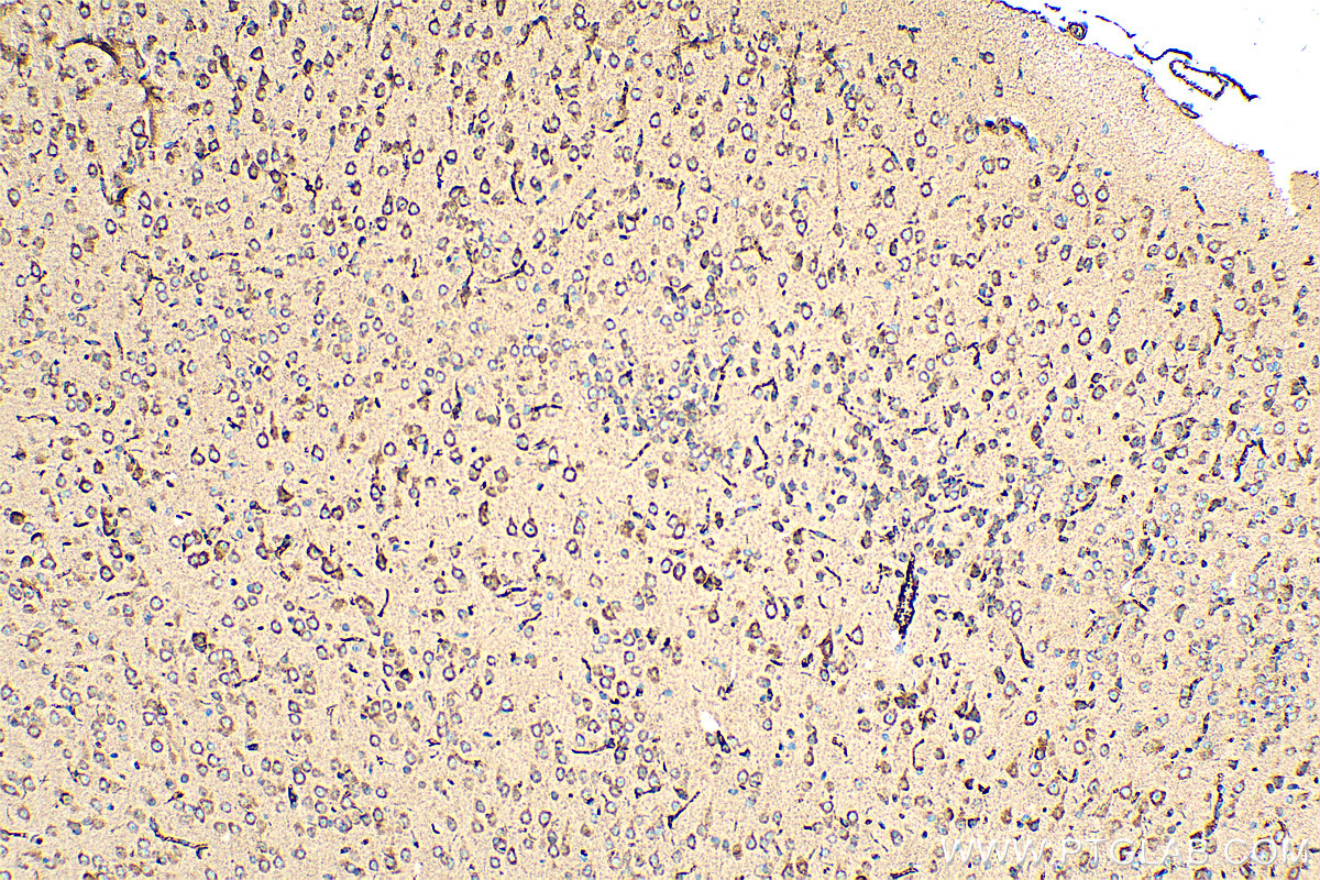 IHC staining of mouse brain using 17481-1-AP