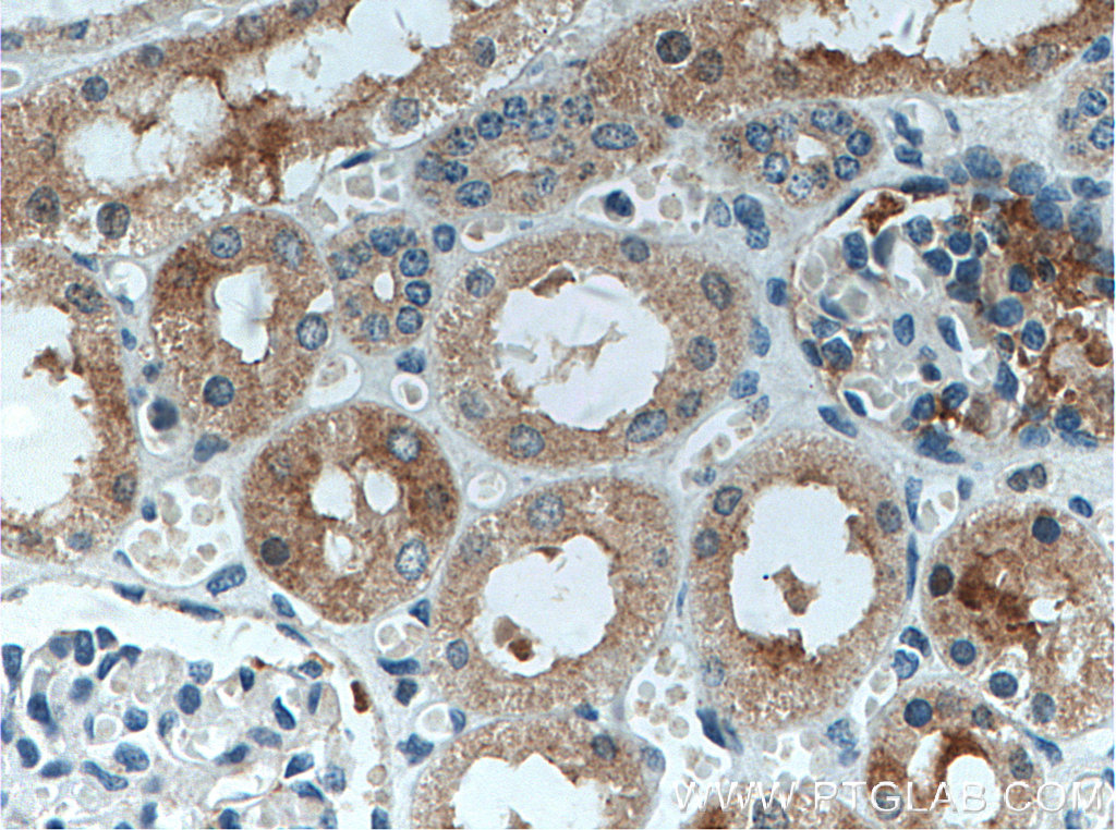 IHC staining of human kidney using 11893-1-AP