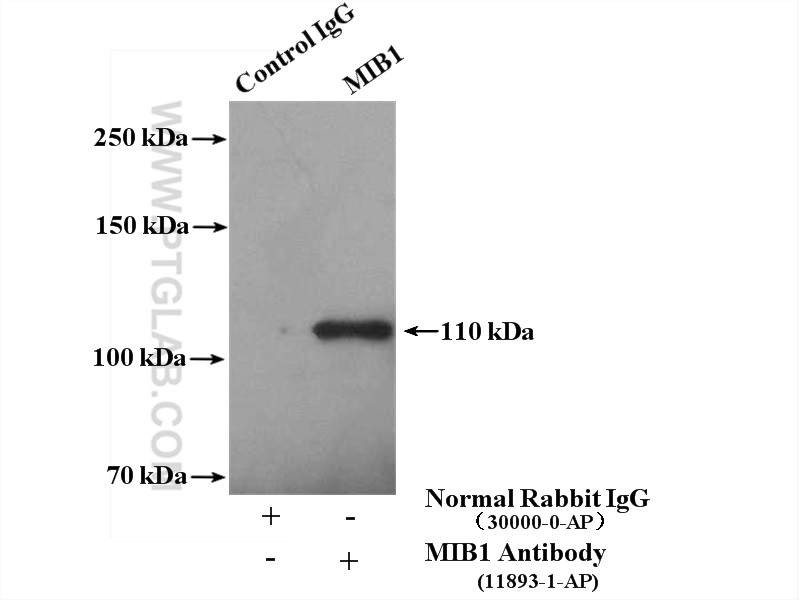 IP experiment of K-562 using 11893-1-AP