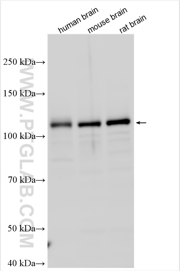 WB analysis using 11893-1-AP