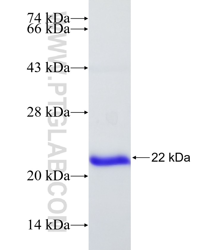MIB1 fusion protein Ag31300 SDS-PAGE MIB1 fusion protein Ag31300 SDS-PAGE