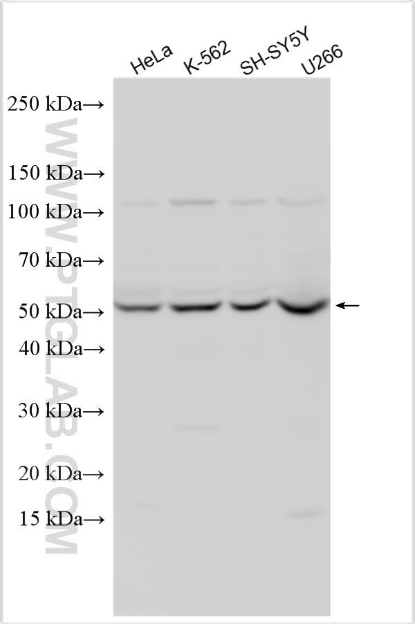 WB analysis using 12619-1-AP