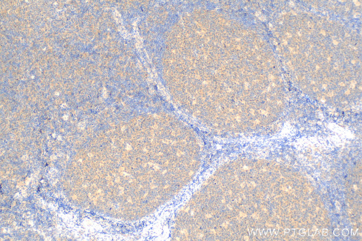 IHC staining of human tonsillitis using Biotin-65161