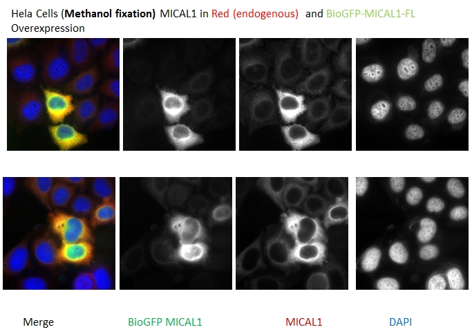 IF Staining of HeLa using 14818-1-AP