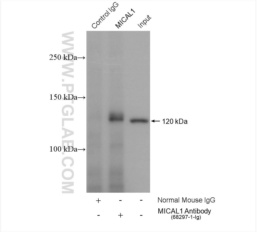 IP experiment of HeLa using 68297-1-Ig