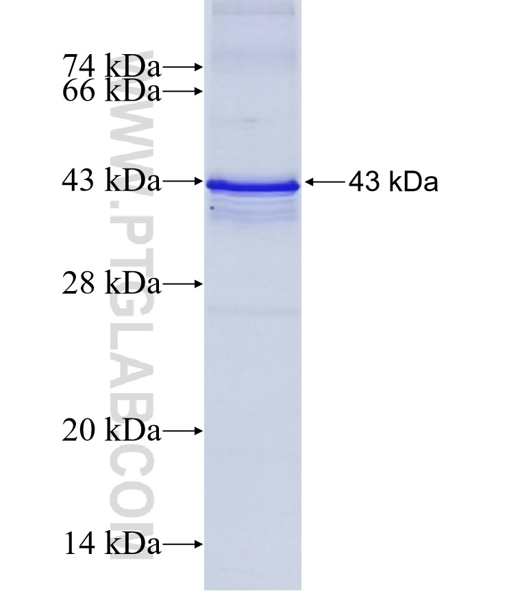 MICAL2 fusion protein Ag5318 SDS-PAGE MICAL2 fusion protein Ag5318 SDS-PAGE